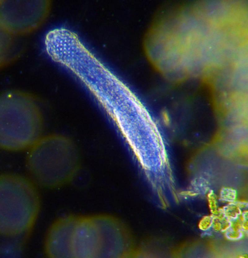 Vi sinh vật Gastrotricha sống dưới tầng đáy của biển sâu