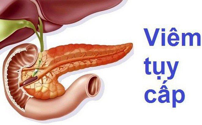 Nghiện rượu bia là một trong những thói quen không tốt làm tăng nguy cơ mắc phải bệnh viêm tụy cấp tính.