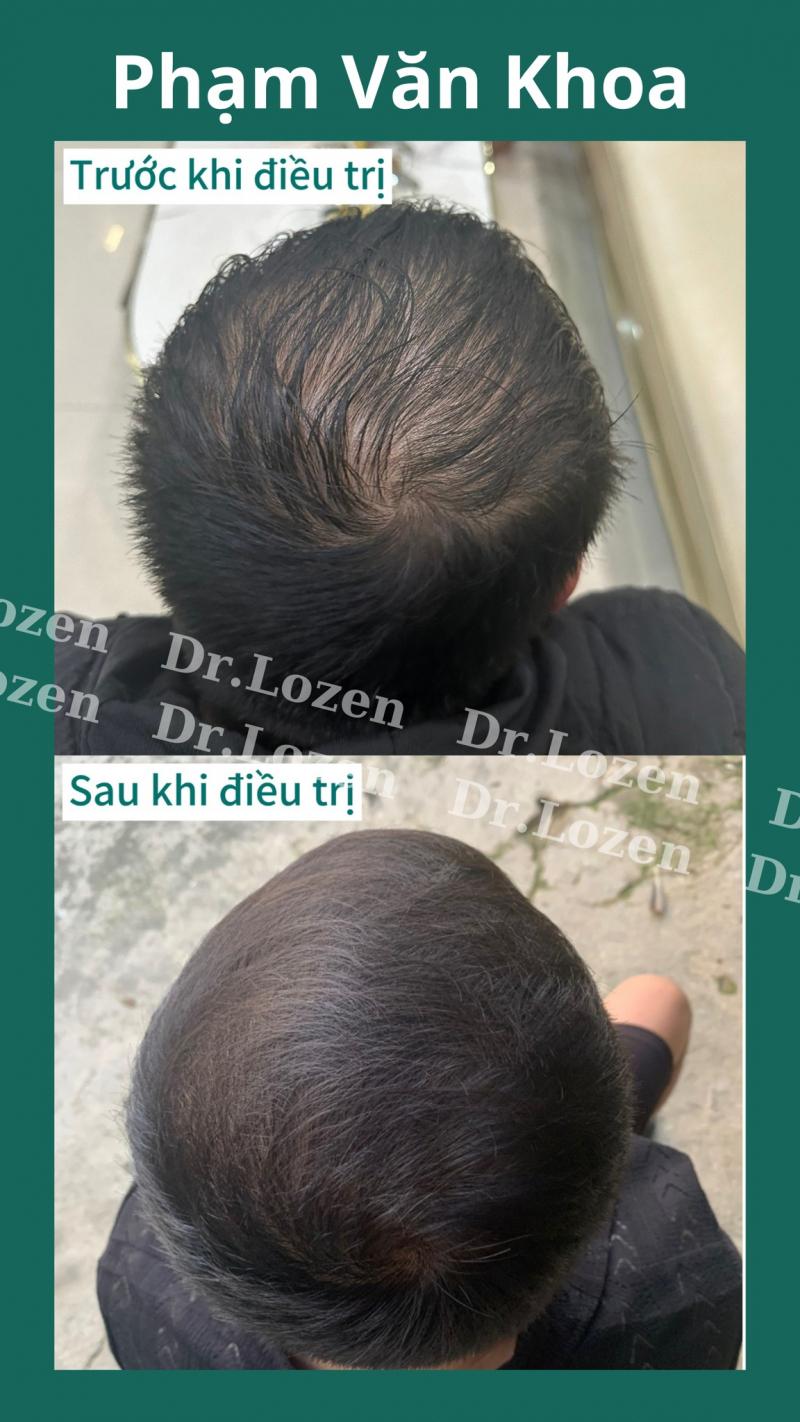 Viện chăm sóc tóc và da đầu Dr Lozen