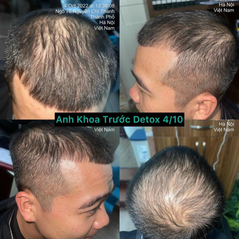 Viện chăm sóc tóc và da đầu Dr Lozen