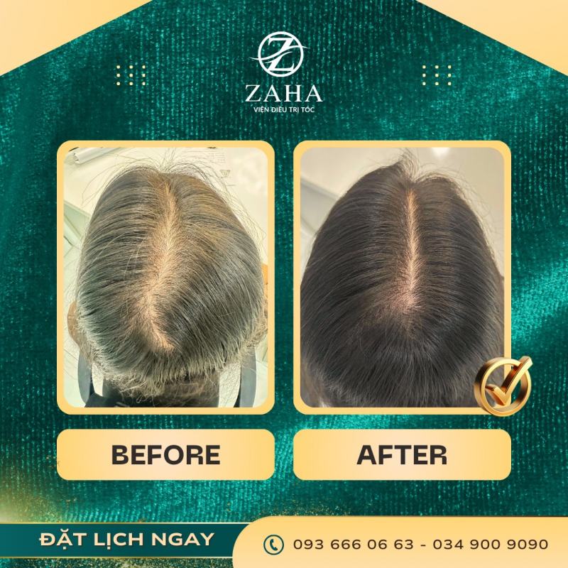 Viện Điều Trị Rụng Tóc & Da Đầu Zaha