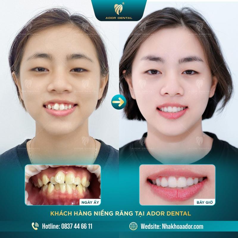 Viện Nha Khoa Thẩm Mỹ Ador Dental