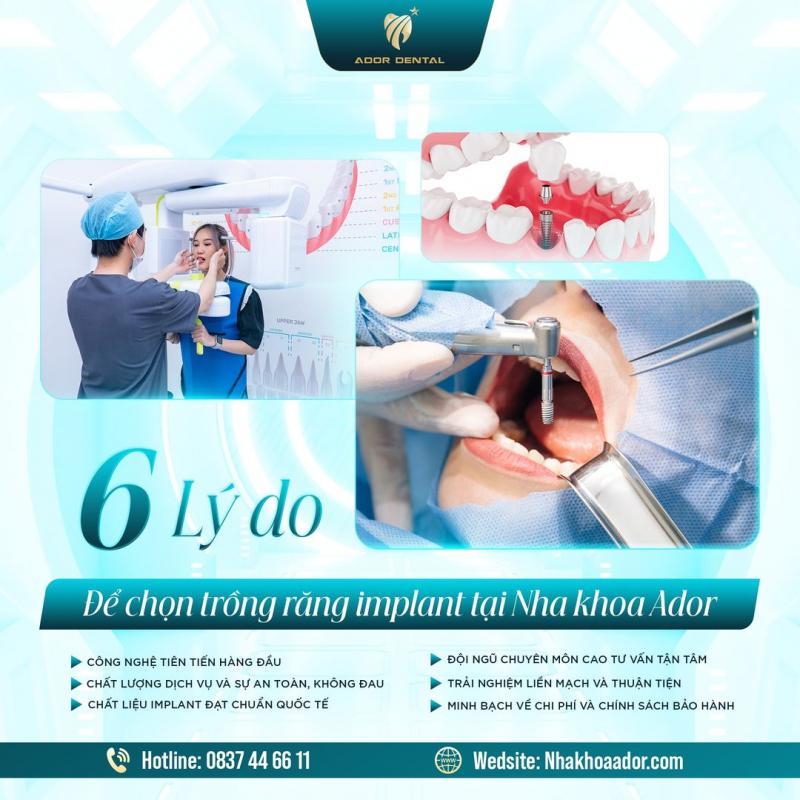 Viện Nha Khoa Thẩm Mỹ Ador Dental