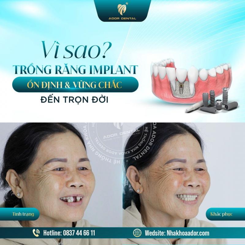 Viện Nha Khoa Thẩm Mỹ Ador Dental