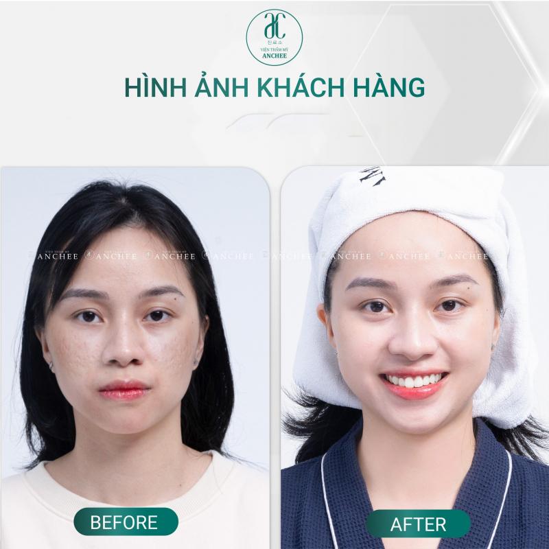 Viện thẩm mỹ Anchee Clinic