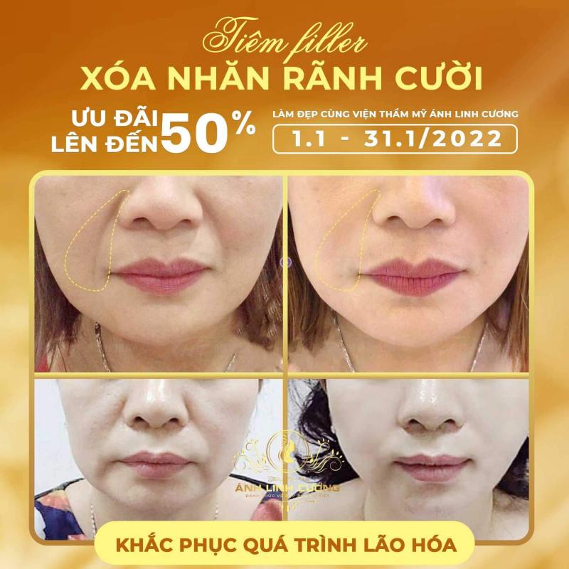 Viện Thẩm Mỹ ÁNH LINH CƯƠNG