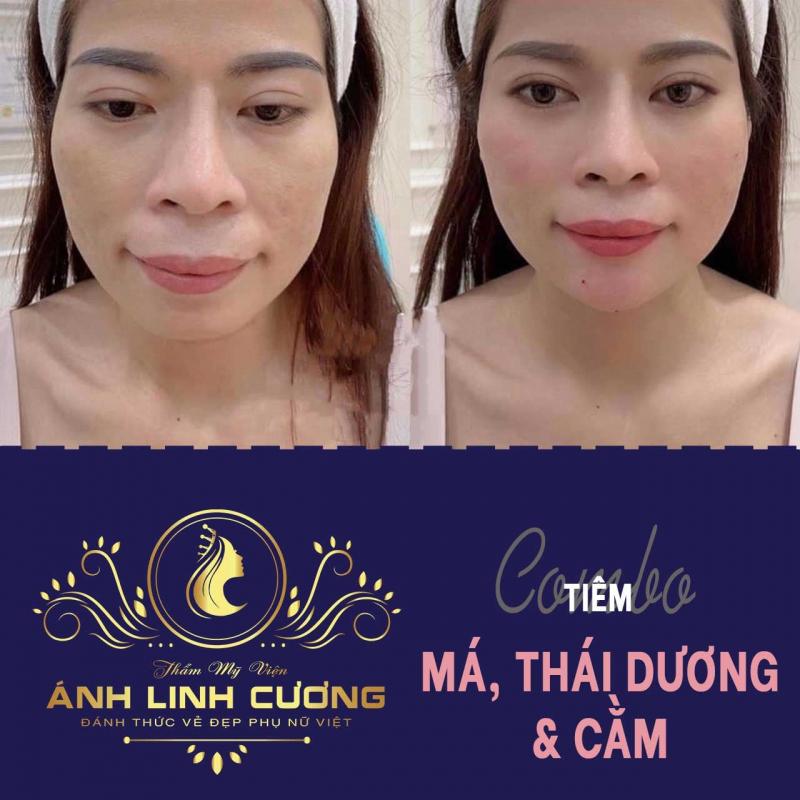 Viện Thẩm Mỹ ÁNH LINH CƯƠNG