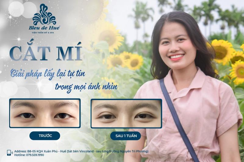 Viện Thẩm Mỹ Bleu de Hué