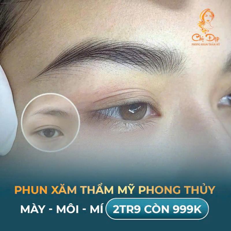 Viện Thẩm Mỹ Chị Đẹp