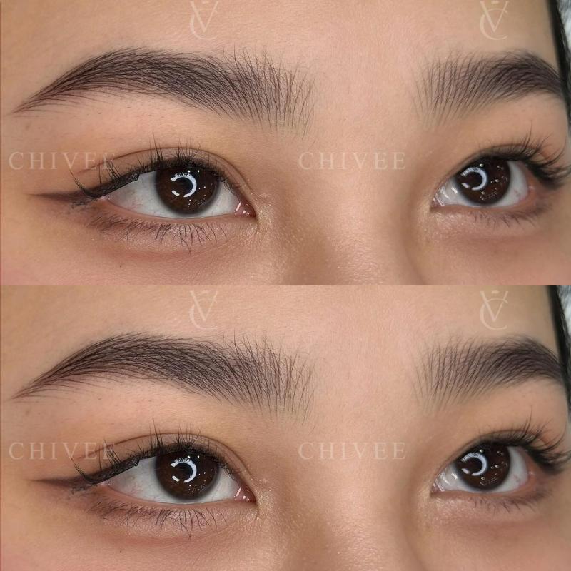 Viện Thẩm Mỹ ChiVee