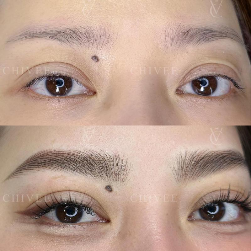 Viện Thẩm Mỹ ChiVee