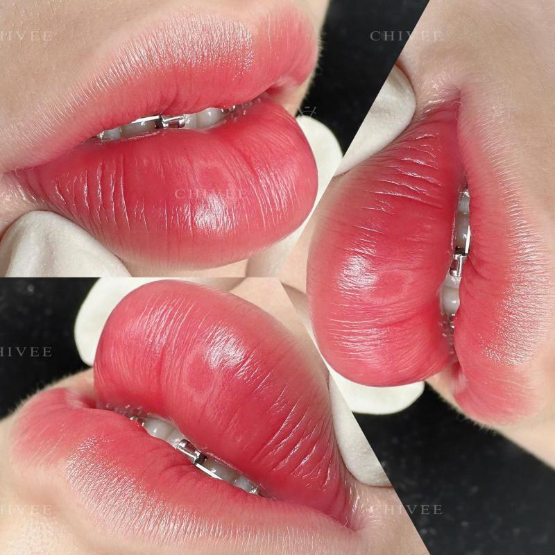 Viện Thẩm Mỹ ChiVee