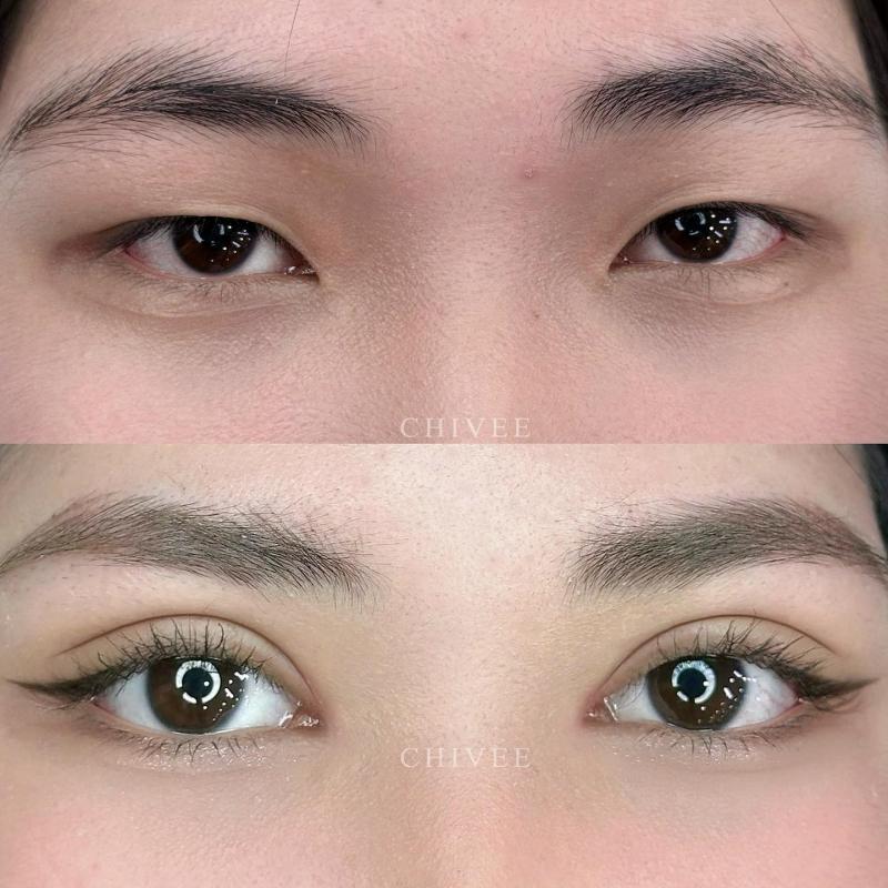 Viện Thẩm Mỹ ChiVee