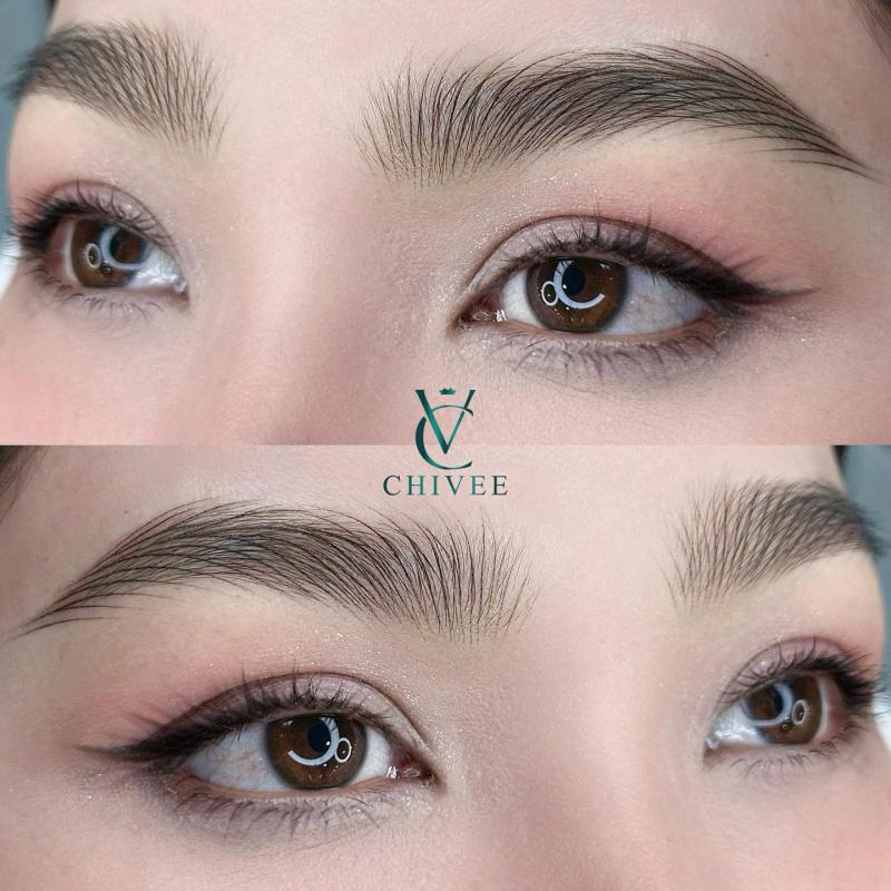 Viện Thẩm Mỹ ChiVee