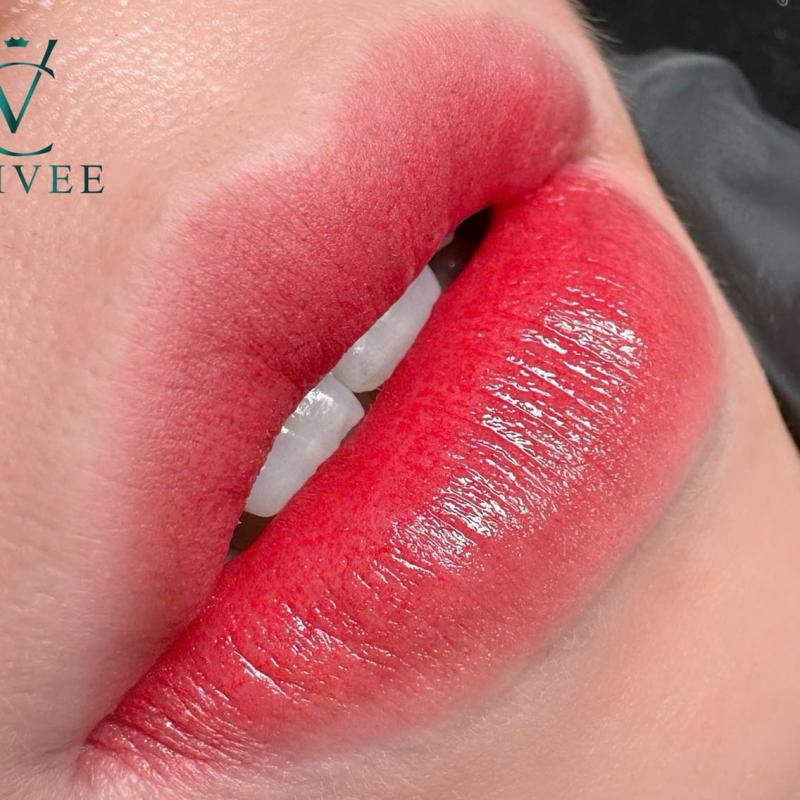 Viện Thẩm Mỹ ChiVee