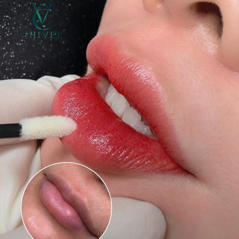 Viện Thẩm Mỹ ChiVee