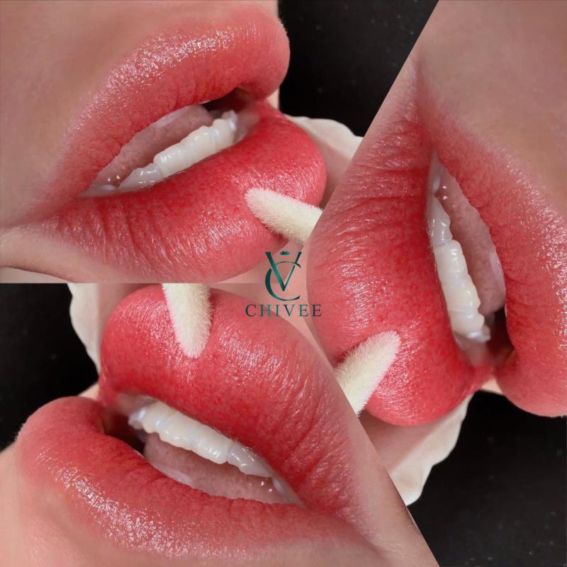 Viện Thẩm Mỹ ChiVee