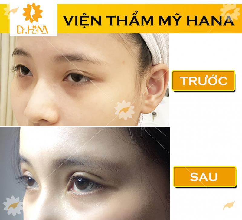 Viện thẩm mỹ Dr.Hana Vũng Tàu