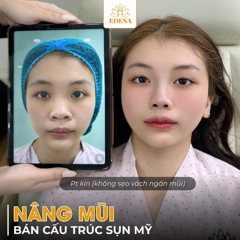 Bệnh Viện Thẩm Mỹ Quốc Tế EDENA