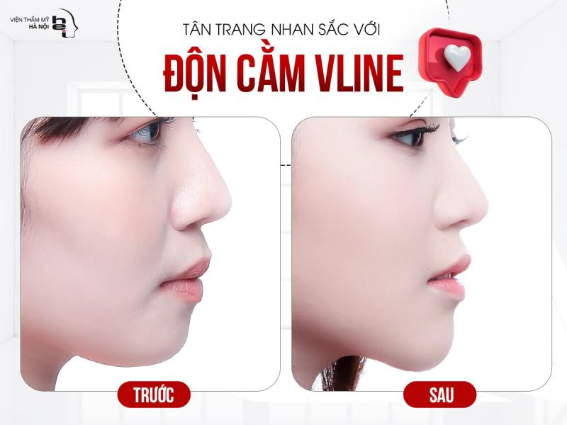 Viện thẩm mỹ Hà Nội