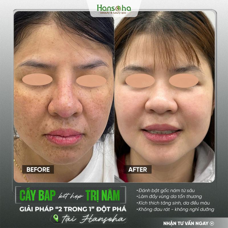 Viện thẩm mỹ Hansoha