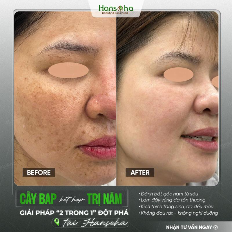 Viện thẩm mỹ Hansoha