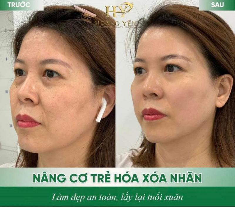 Viện Thẩm Mỹ Hoàng Yến