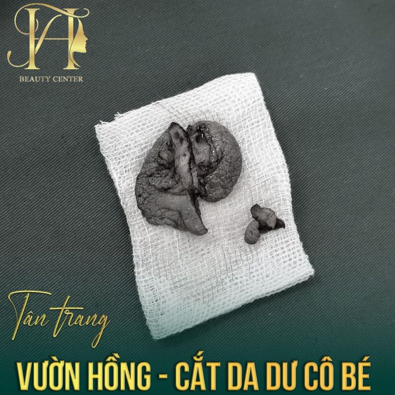 Viện thẩm mỹ HT