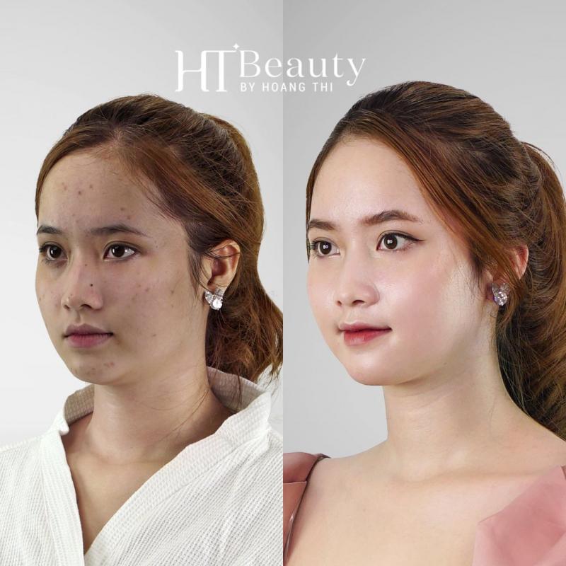 Viện thẩm mỹ HT Beauty