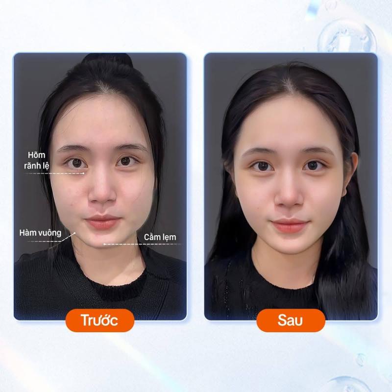 Viện Thẩm Mỹ Kangnam Cần Thơ