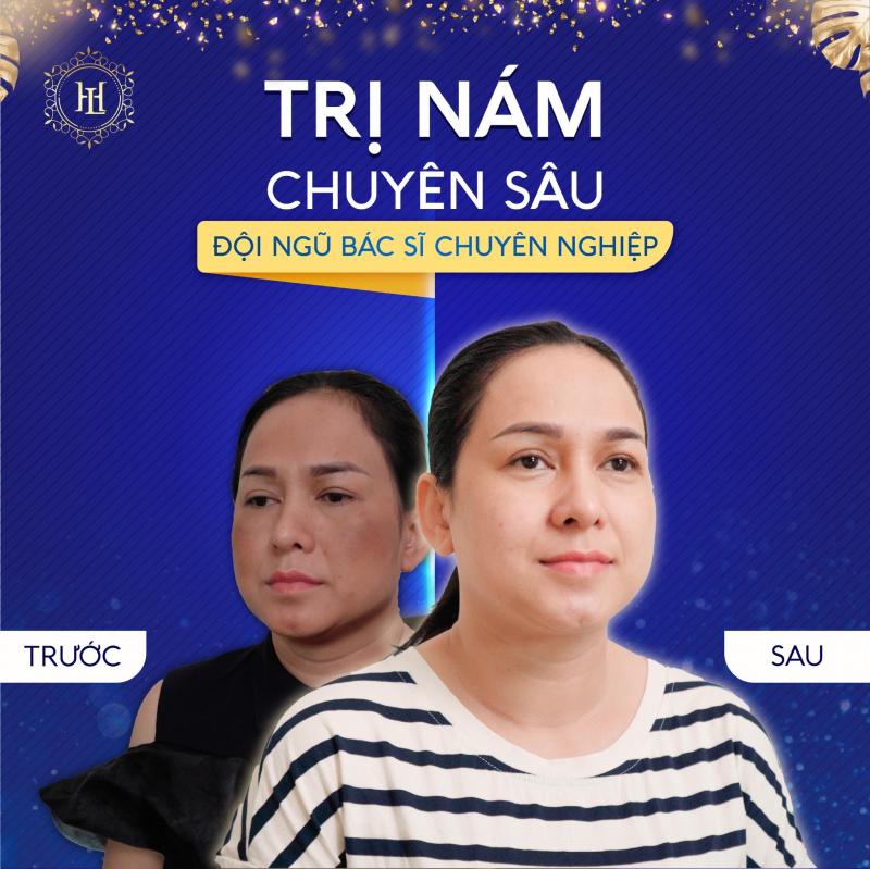 Viện Thẩm Mỹ Lê Hoài