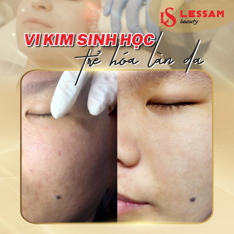 Thẩm mỹ viện Les Sam - CN Tân Bình