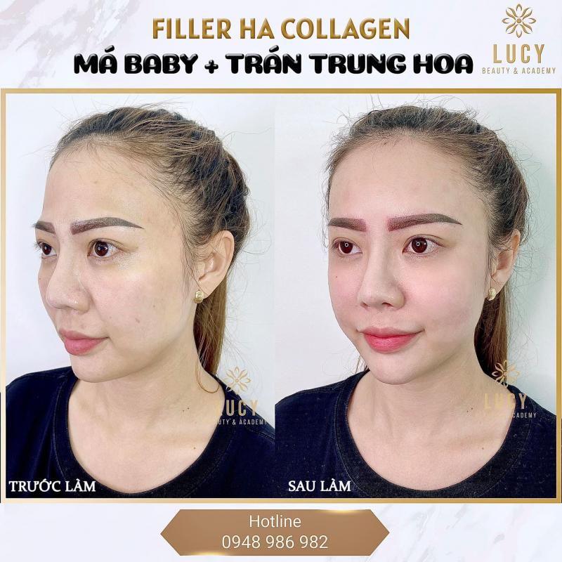 Viện Thẩm Mỹ Lucy - Vũ Thị Phụng