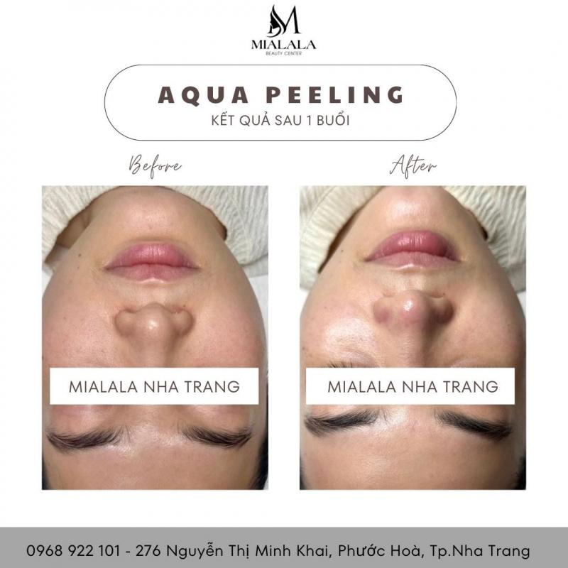 Viện Thẩm Mỹ Mialala