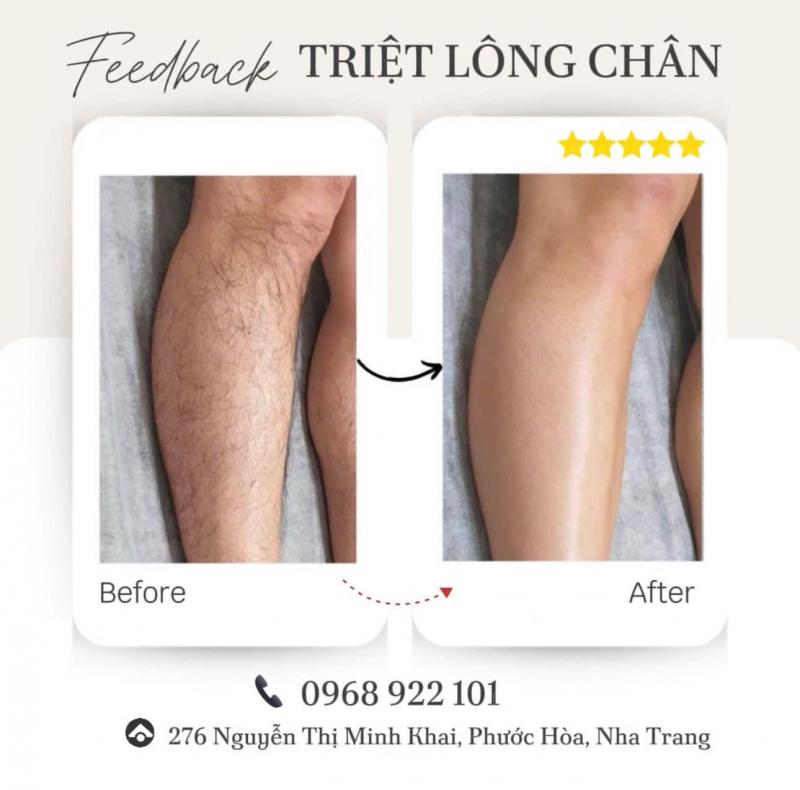 Viện Thẩm Mỹ Mialala