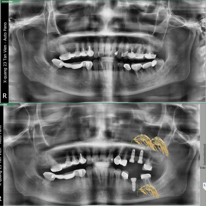 Viện Thẩm Mỹ Nha Khoa – Phố Cổ Luxury Dental