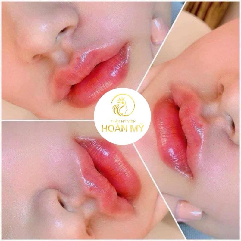 Viện Thẩm Mỹ Quốc Tế Hoàn Mỹ