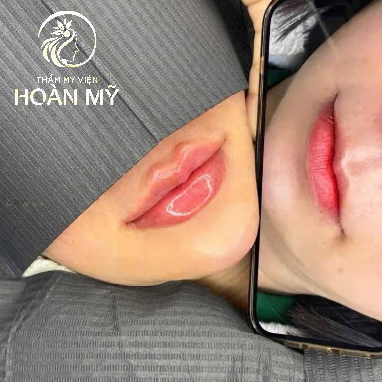 Viện Thẩm Mỹ Quốc Tế Hoàn Mỹ