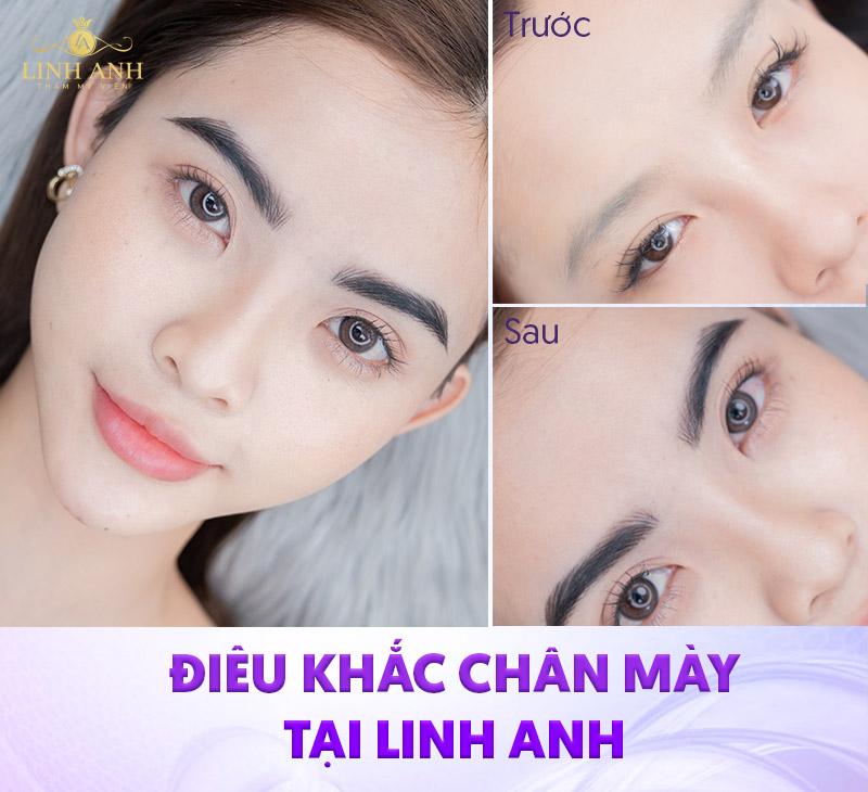 Viện Thẩm mỹ Quốc Tế Linh Anh