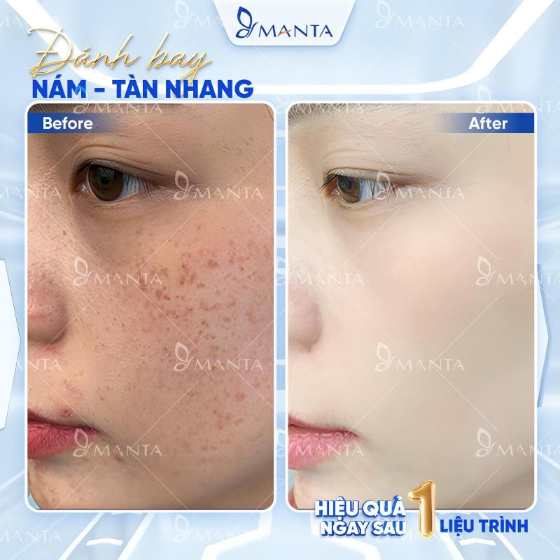 Viện Thẩm Mỹ Quốc Tế Manta