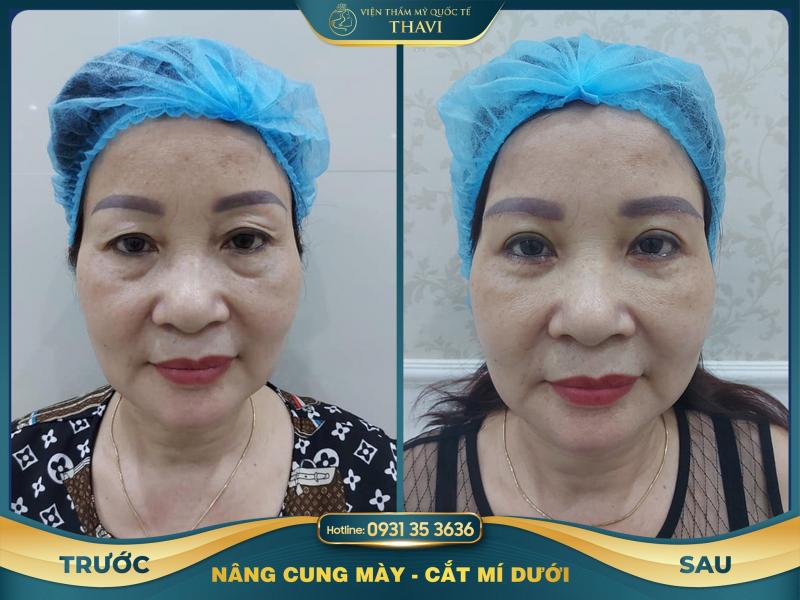 Viện Thẩm Mỹ Quốc Tế Thavi