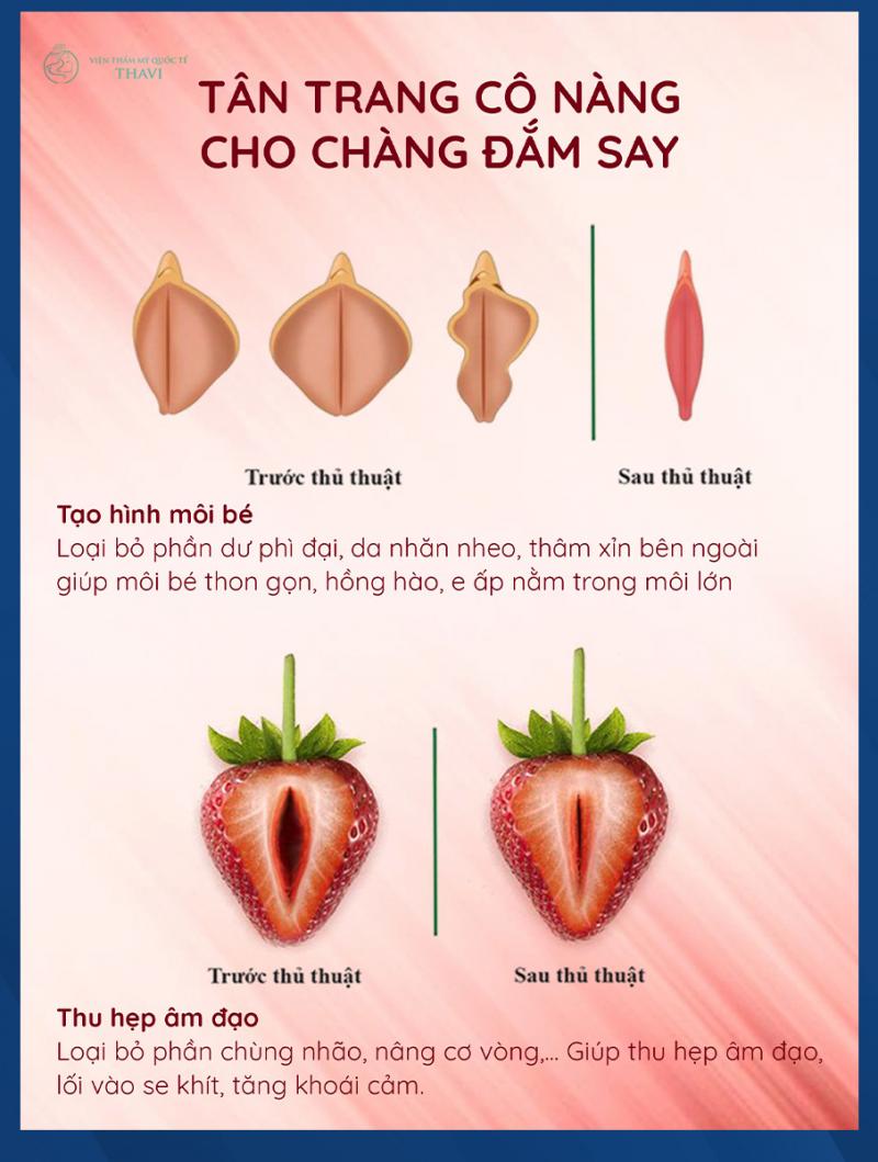 Viện Thẩm Mỹ Quốc Tế Thavi