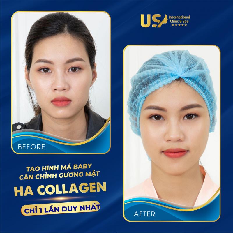 Viện Thẩm Mỹ Quốc Tế Us Beauty