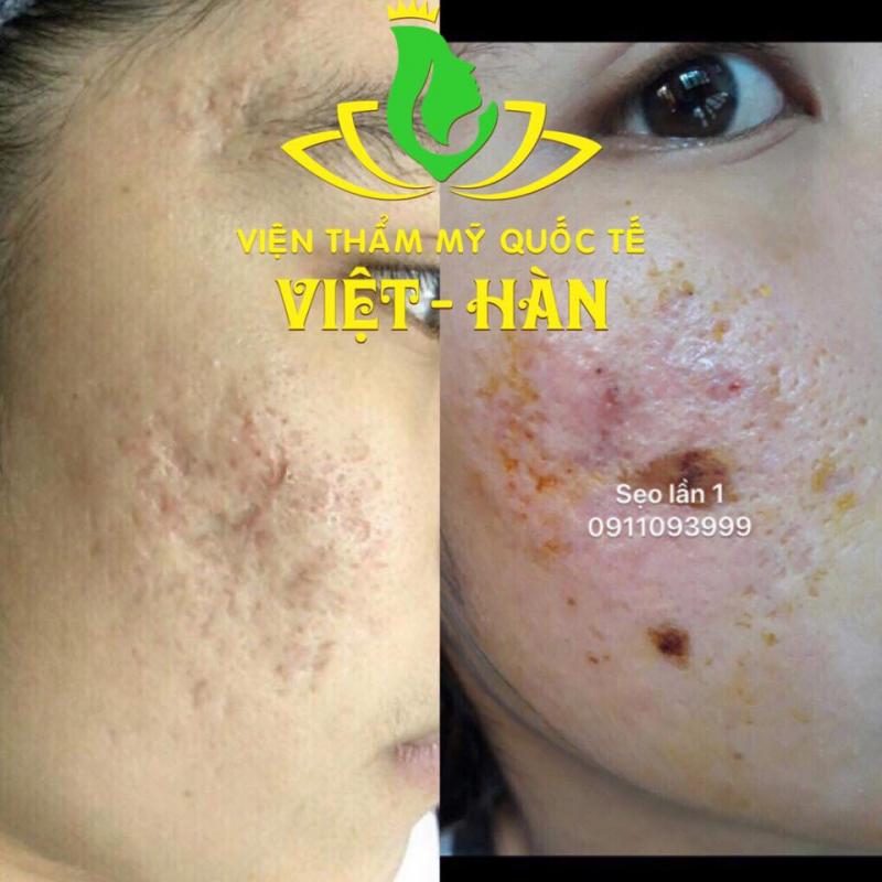 Viện Thẩm Mỹ Quốc Tế - Việt Hàn