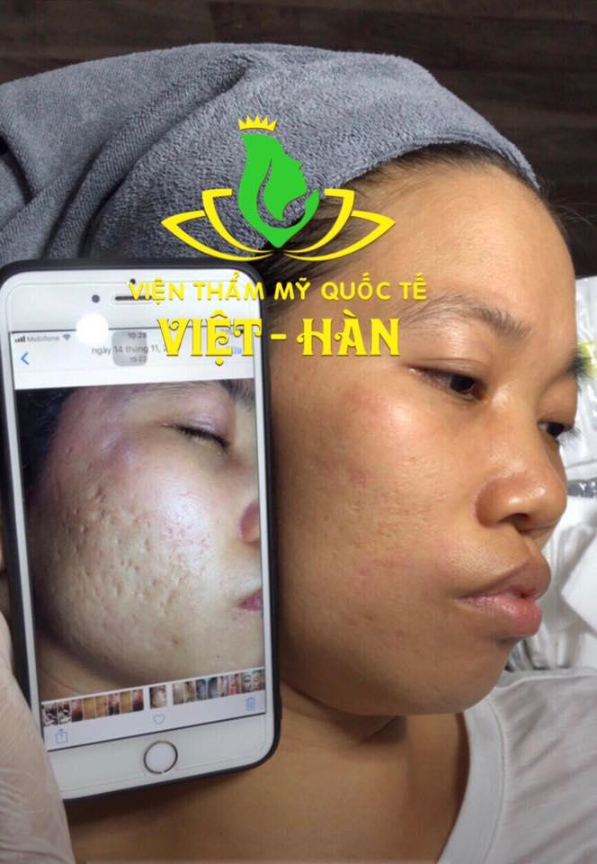 Viện Thẩm Mỹ Quốc Tế - Việt Hàn