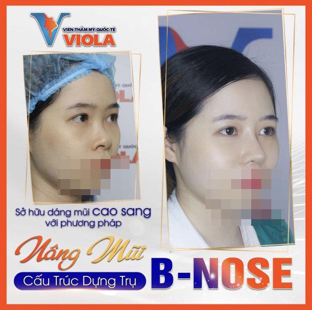 Viện Thẩm Mỹ Quốc Tế Viola