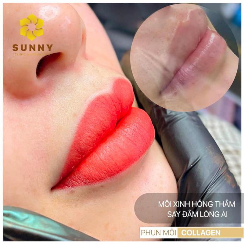 Viện Thẩm Mỹ Sunny