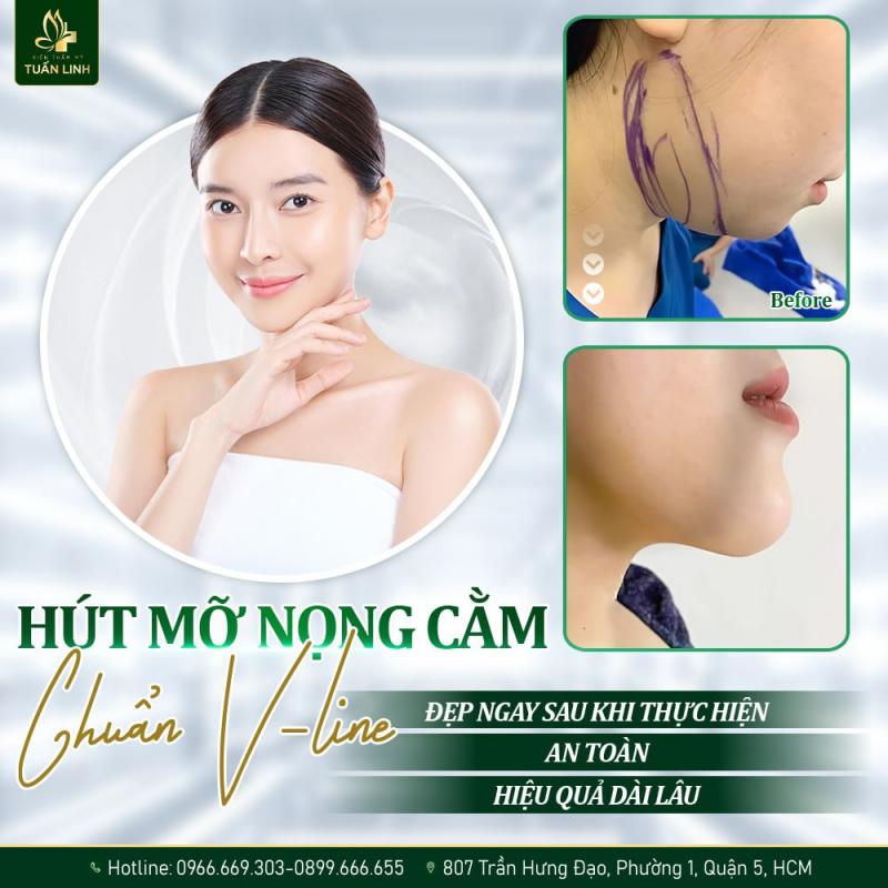 Viện thẩm mỹ Tuấn Linh
