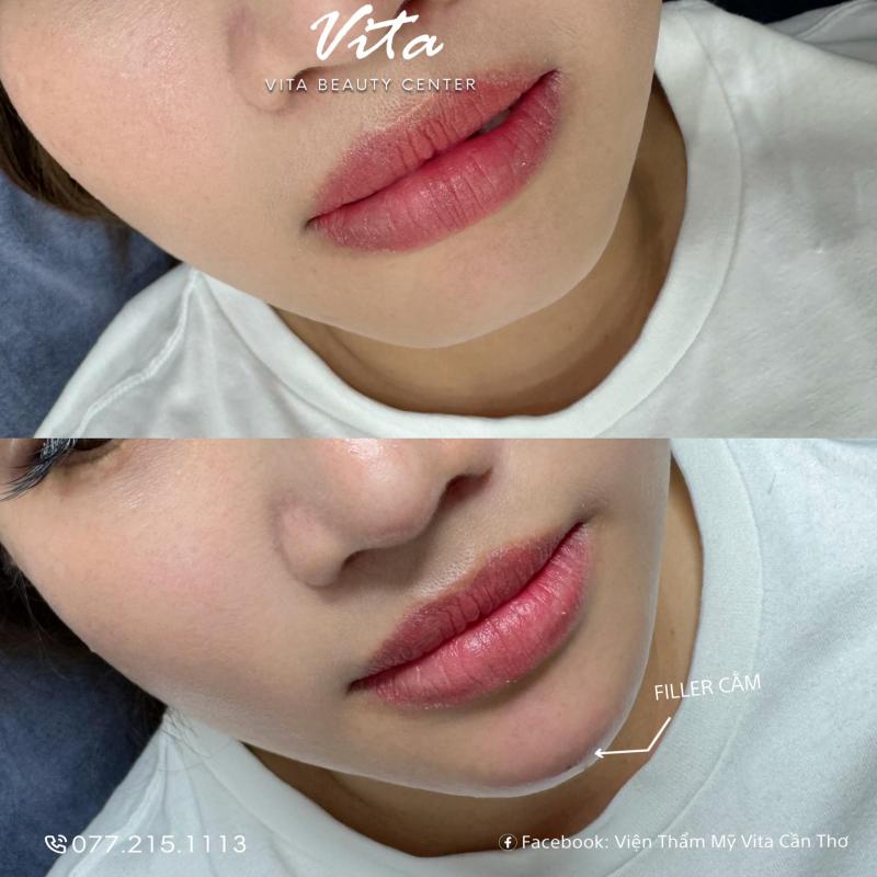 Viện Thẩm Mỹ ViTa