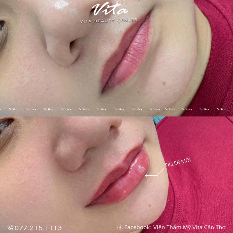 Viện Thẩm Mỹ ViTa